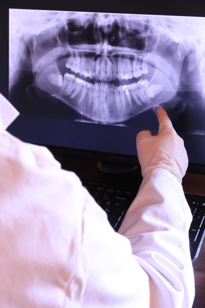 Best Broken or Chipped Tooth Repair in Johnstown, PA